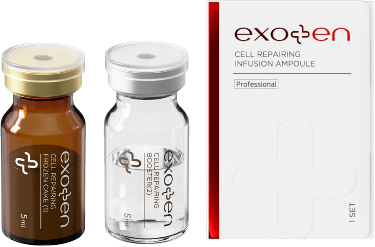 Exoten（エクソテン）